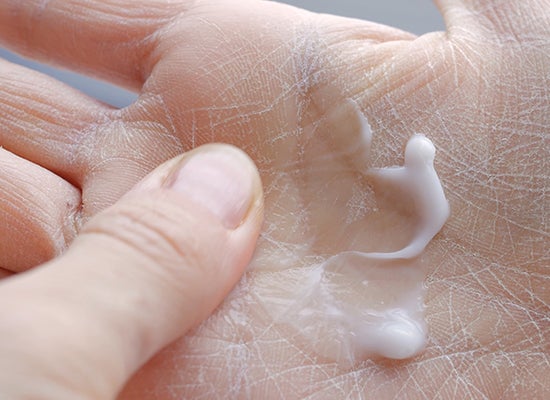 Kuru el cildine nemlendirici krem ​​uygulayan kişi